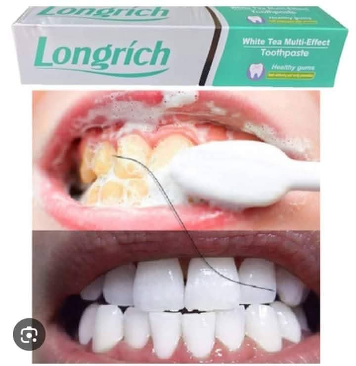 K4I7Z98zO15Lw9cxOfAVrOIjLY8EdThgW5vEzUDB.jpg
